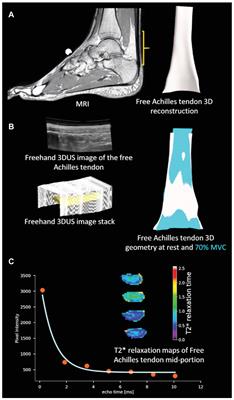 The Free Achilles Tendon Is Shorter, Stiffer, Has Larger Cross-Sectional Area and Longer T2* Relaxation Time in Trained Middle-Distance Runners Compared to Healthy Controls